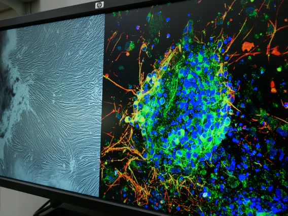 A close-up of a computer screen showing two scientific images: a grayscale cell texture and a brightly colored neural cell cluster.