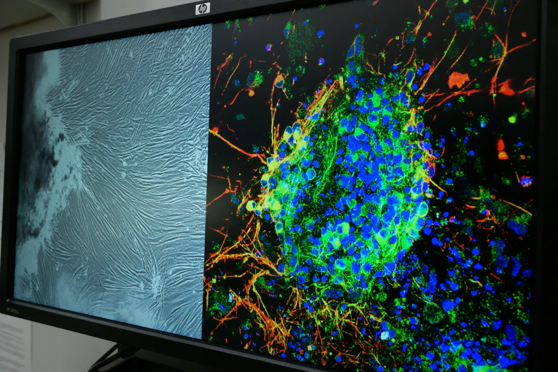 A close-up of a computer screen showing two scientific images: a grayscale cell texture and a brightly colored neural cell cluster.